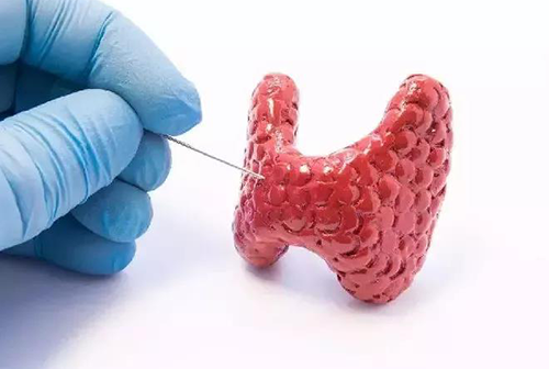 甲状腺疾病，包括甲状腺功能减退和甲状腺功能亢进，自古以来就是反复被医学研究人员研究的疾病